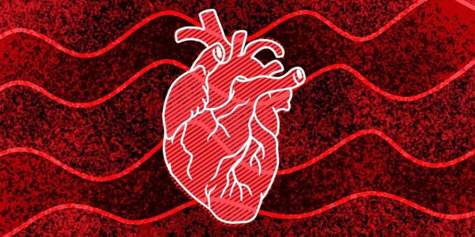 11 znakov, da se lahko zgodi, srčni zastoj