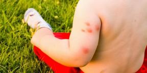 Kaj storiti, če ste alergični na pike komarjev in mušic