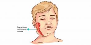 Od kod prihaja mumps, kakšni so njegovi simptomi in kako ga zdraviti