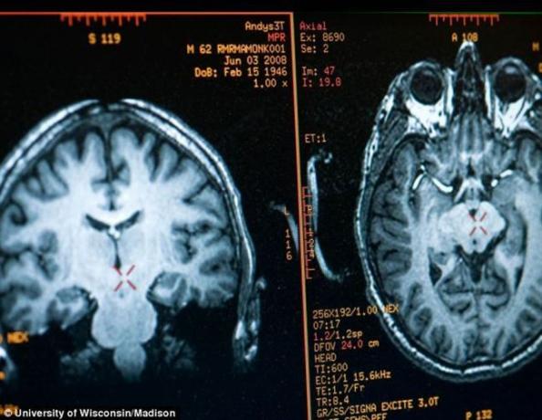 možgani Mathieu Ricard sliko dobimo z MRI