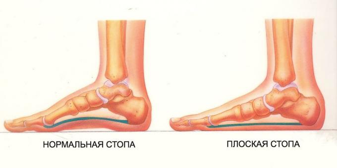 vaje za ravne noge: normalno in ravno peš
