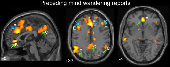 Zelene puščice označujejo območja možganov, odgovoren za "avtomatsko vedenje". Modra puščica - za "izvršni" del možganov. A - hrbtna cingulusne, B - ventralanya cingulusne, C - precuneus možganski hemisferi, D - dvostranski temporoparietal razdelilne E - dorsolateral prefrontal korteks
