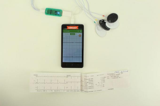 EKG Dongle