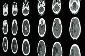 3 znanstveno potrditev neverjetno značilnosti naše možgane