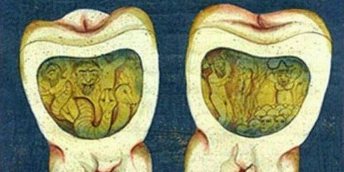 Srednjeveška medicina: stran iz osmanske zobozdravstvene razprave, 17. stoletje.