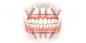 Kako obnoviti zobe in nasmeh nazaj
